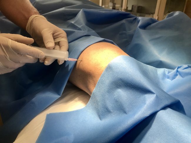 zdjęcie ewentualnie do użycia w artykule jak działa kwas hailuronowy kwas hialuronowy