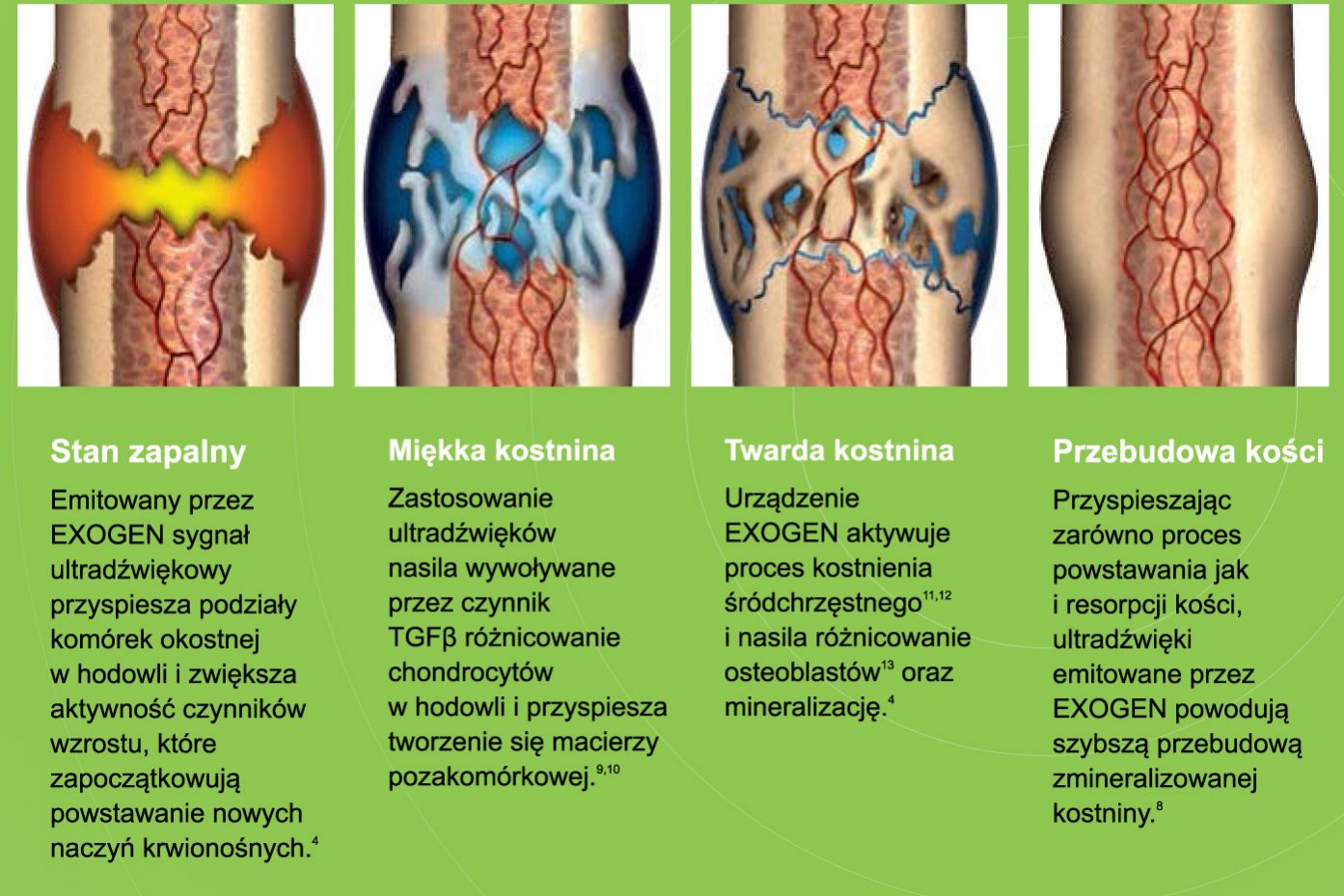 Obrazek2_Big gojenie złamań