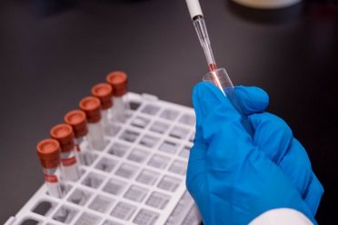 osocze bogatopłytkowe