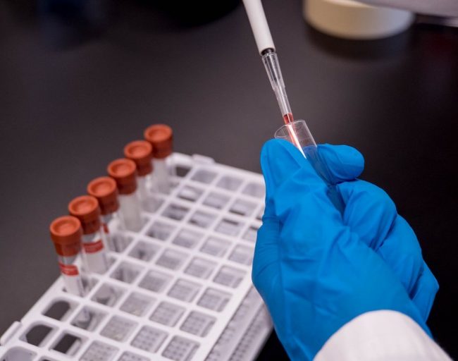 trust-tru-katsande-HQM5jm12etE-unsplash osocze bogatopłytkowe