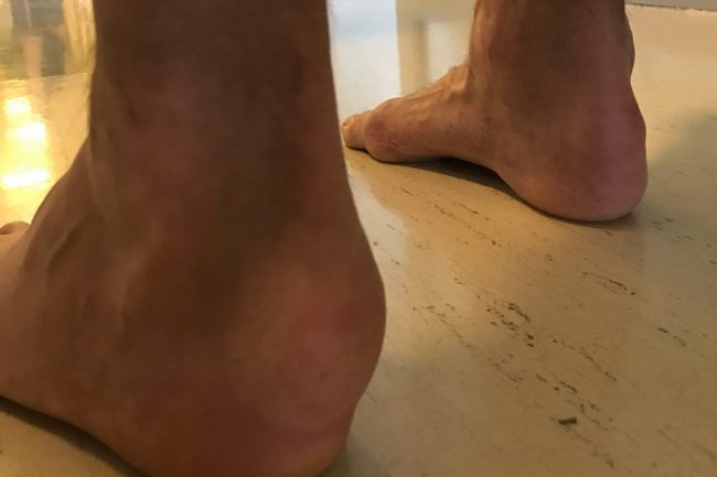 Pięta Haglunda Pięta Haglunda