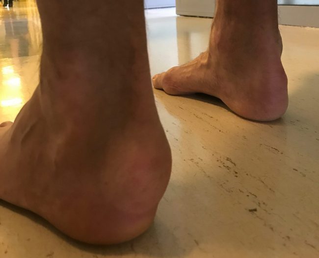 Pięta Haglunda Pięta Haglunda