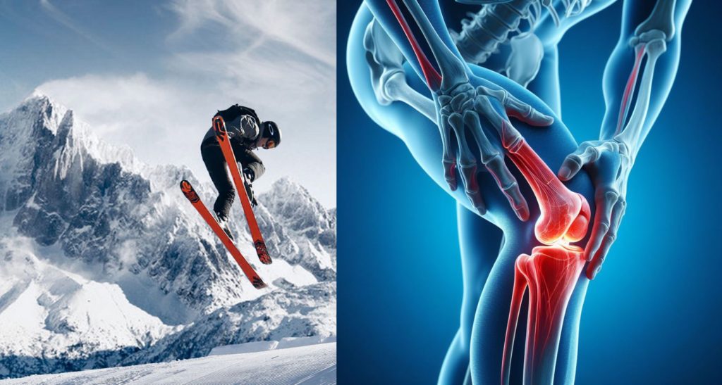 Sezon narciarski i skręcenie kolana! – czy operacja jest zawsze konieczna?