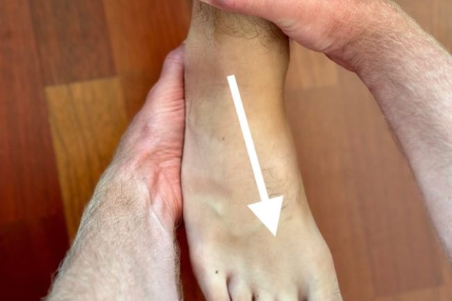 skręcenie stawu skokowego rozpoznanie1
