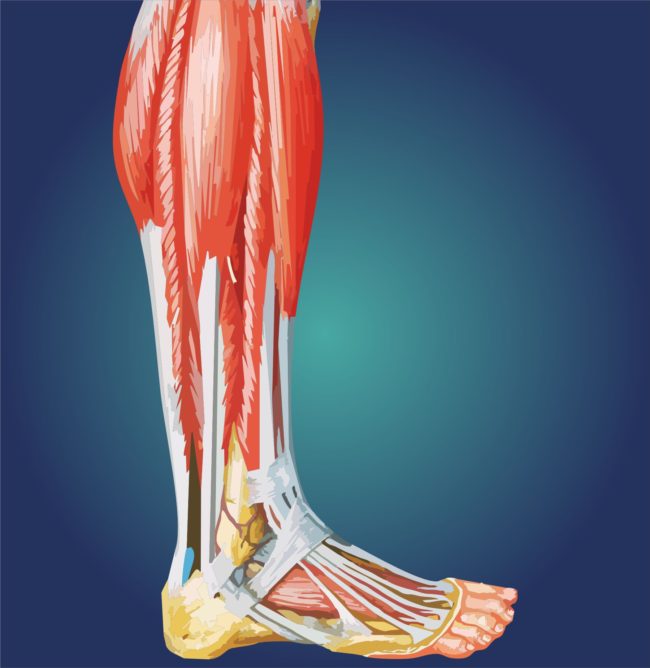 ścięgno-achillesa-kontuzja-uszkodzenie-1