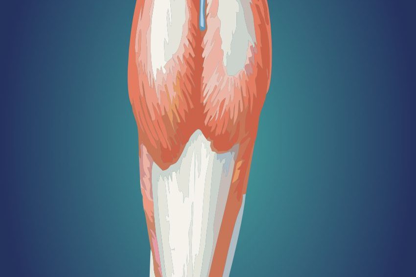 ścięgno-achillesa-kontuzja